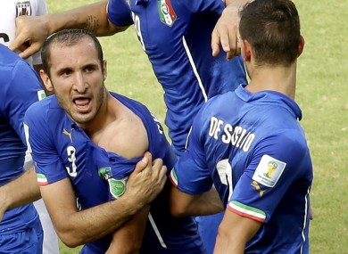 Italy's Giorgio Chiellini displays his shoulder showing apparent teeth marks after colliding with Luis Suarez.